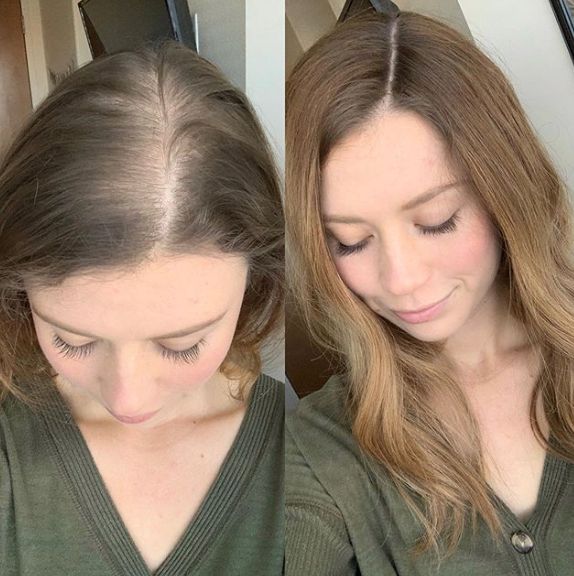 KokoRean - Retrouvez vos cheveux d'avant naturellement