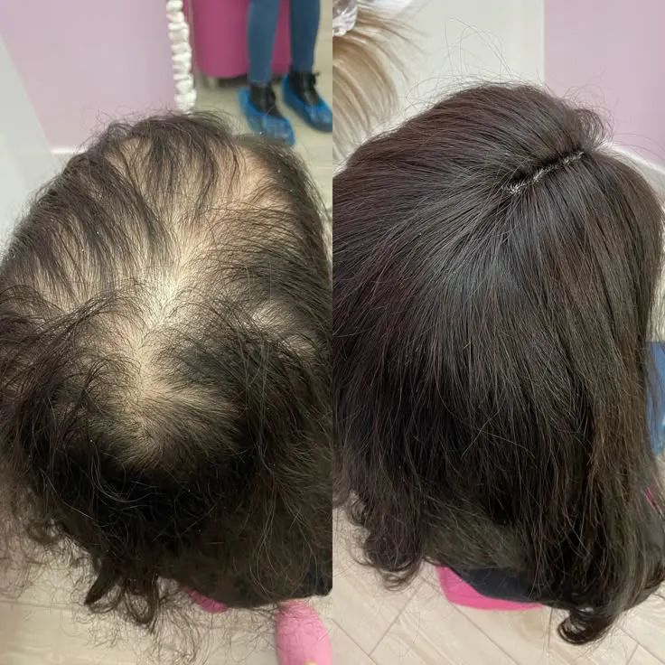 KokoRean - Retrouvez vos cheveux d'avant naturellement